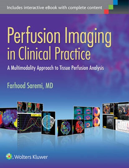 Perfusion Imaging in Clinical Practice, Farhood Saremi - Gebonden - 9781451193169