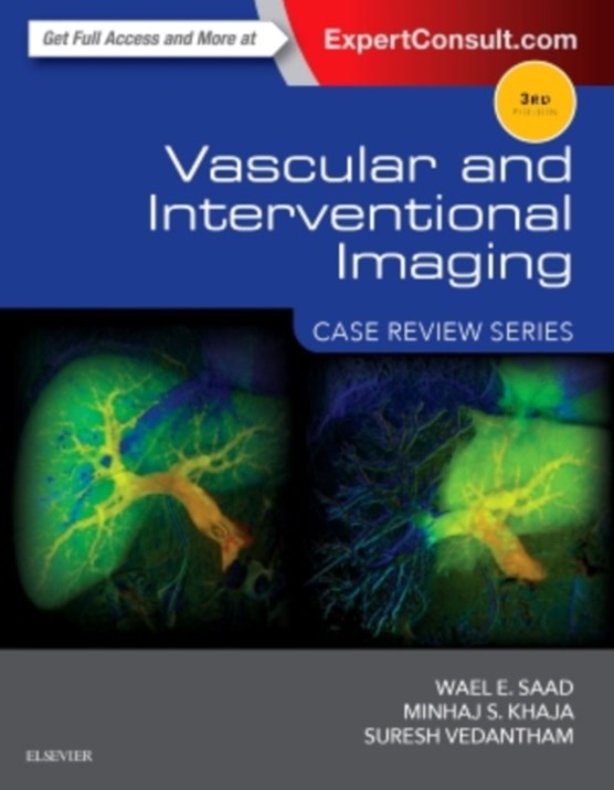 Vascular and Interventional Imaging: Case Review Series