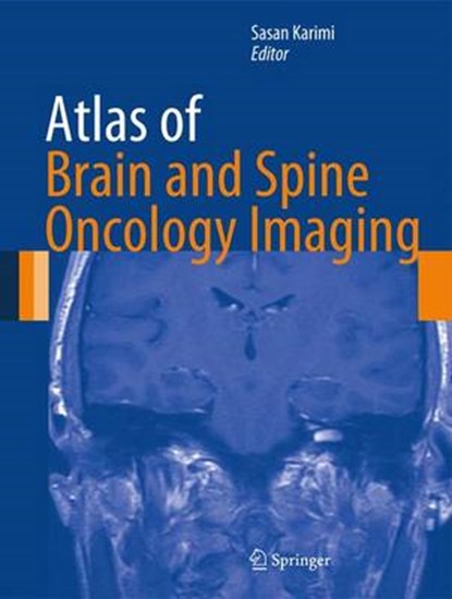 Atlas of Brain and Spine Oncology Imaging, Sasan Karimi - Gebonden - 9781461456520