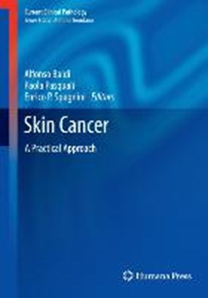 Skin Cancer, Alfonso Baldi ; Paola Pasquali ; Enrico P. Spugnini - Gebonden - 9781461473565