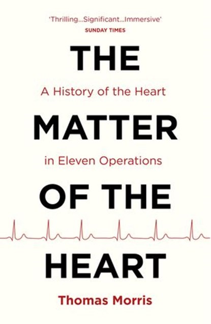 The Matter of the Heart, Thomas Morris - Ebook - 9781473524729