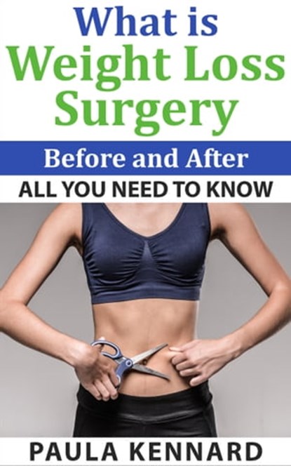 What Is Weight Loss Surgery: All You Need To Know Before And After, Paula Kennard - Ebook - 9781476492650