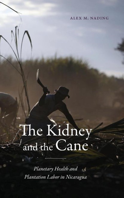 The Kidney and the Cane, Alex M. Nading - Gebonden - 9781478028666