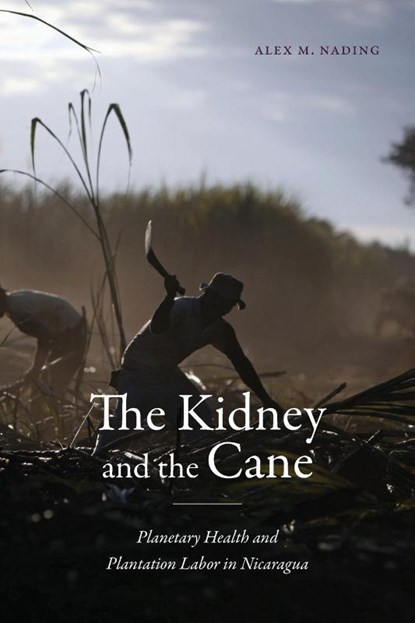 The Kidney and the Cane, Alex M. Nading - Paperback - 9781478031871