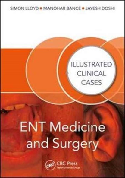 ENT Medicine and Surgery, Jayesh (Consultant ENT Surgeon Doshi ; Manohar (Professor of Otology & Skull Base Surgery Bance ; Simon (Professor of Otology and Skull base surgery Lloyd - Paperback - 9781482230413