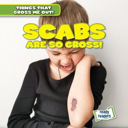 Scabs Are So Gross!, Lynda Arnez - Paperback - 9781482471441