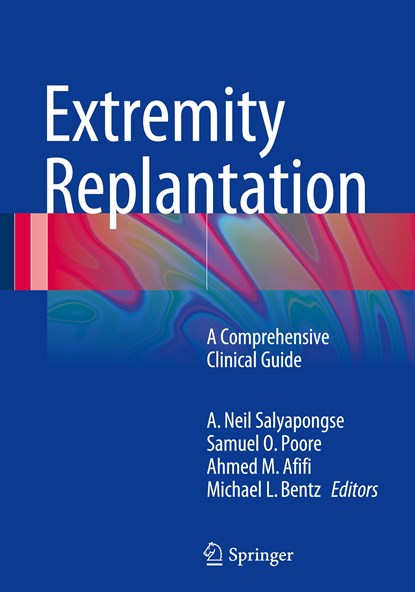 Extremity Replantation, A Neil Salyapongse ;  Samuel Poore ;  Ahmed Afifi ;  Michael Bentz - Gebonden - 9781489975157