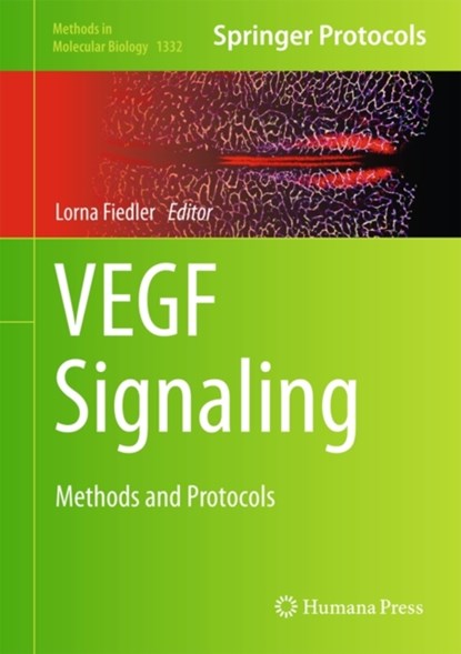 VEGF Signaling, niet bekend - Gebonden - 9781493929160