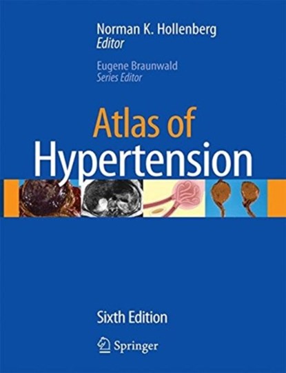 Atlas of Hypertension, Norman K. Hollenberg - Paperback - 9781493939411