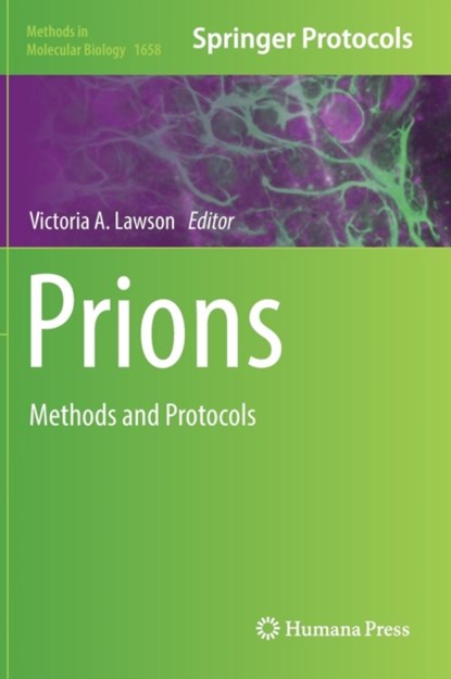 Prions, niet bekend - Gebonden - 9781493972425