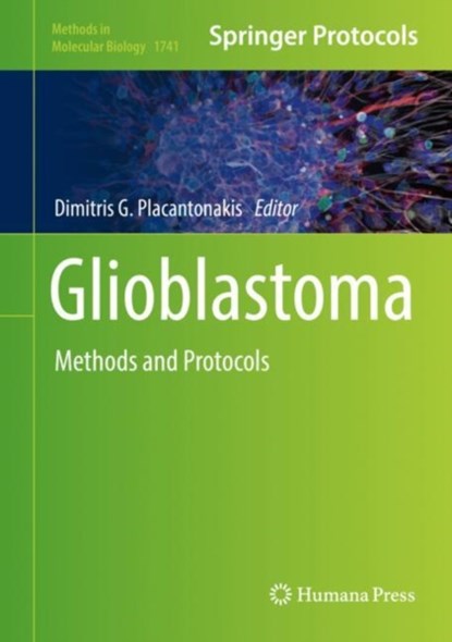 Glioblastoma, niet bekend - Gebonden - 9781493976584