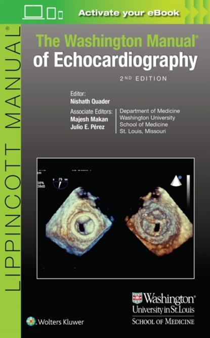 The Washington Manual of Echocardiography, NISHATH,  M.D. Quader ; Majesh, MD, FACC, FASE Makan ; Julio Perez - Paperback - 9781496321282