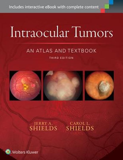 Intraocular Tumors: An Atlas and Textbook, SHIELDS,  Dr. Jerry A. ; Shields, Dr. Carol L. - Gebonden - 9781496321343