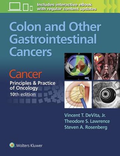 Colon and Other Gastrointestinal Cancers, DEVITA,  Vincent T - Paperback - 9781496333964