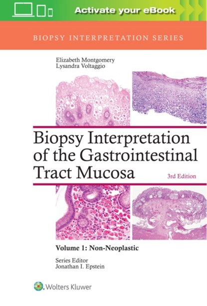 Biopsy Interpretation of the Gastrointestinal Tract Mucosa: Volume 1: Non-Neoplastic, Elizabeth A. Montgomery ; Lysandra Voltaggio - Gebonden - 9781496337276