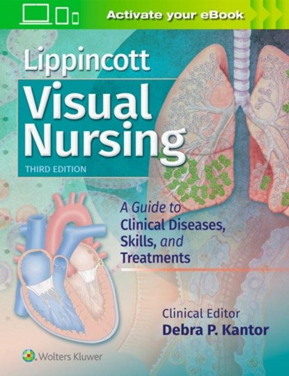 Lippincott Visual Nursing, Lippincott Williams & Wilkins - Paperback - 9781496381781