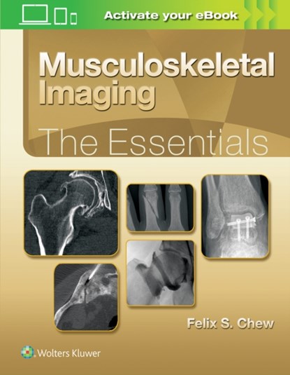 Musculoskeletal Imaging: The Essentials, Felix S. Chew - Gebonden - 9781496383839