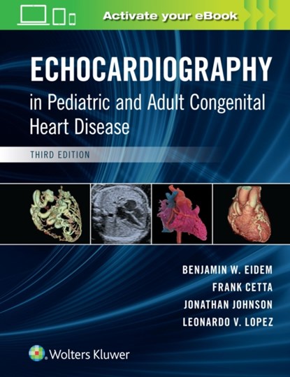Echocardiography in Pediatric and Adult Congenital Heart Disease, BENJAMIN W.,  MD, FACC, FASE Eidem ; Frank Cetta ; Johnathan Johnson ; Leo Lopez - Gebonden - 9781496394019