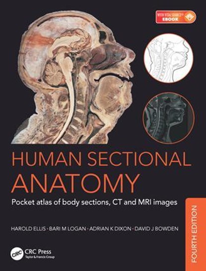 Human Sectional Anatomy, Bari M. Logan ; Harold (Sala Abdalla BSc MBBS MRCS is a senior Specialist Registrar in General Surgery based in London and a member of the Royal College of Surgeons of England Ellis ; Adrian Kendal (Emeritus Professor Dixon ; David J. (Abdominal Imaging Fellow Bowden - Paperback - 9781498708548