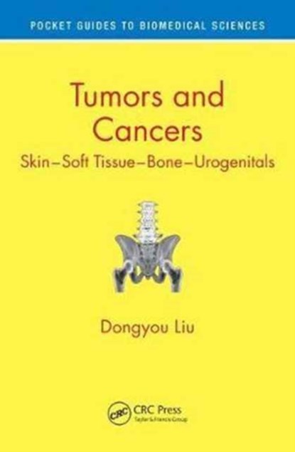 Tumors and Cancers, DONGYOU (ROYAL COLLEGE OF PATHOLOGISTS OF AUSTRALASIA,  St. Leonards, New South Wales, Australia) Liu - Paperback - 9781498729772