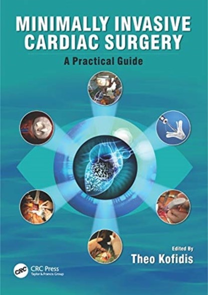 Minimally Invasive Cardiac Surgery, Theo (National University Health System Kofidis - Gebonden - 9781498736466