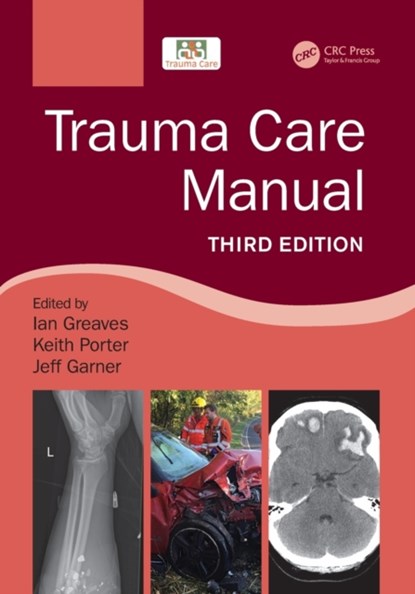 Trauma Care Manual, Ian (University of Teeside. British Army) Greaves ; Sir Keith (University of Birmingham.) Porter ; Jeff Garner - Paperback - 9781498788847