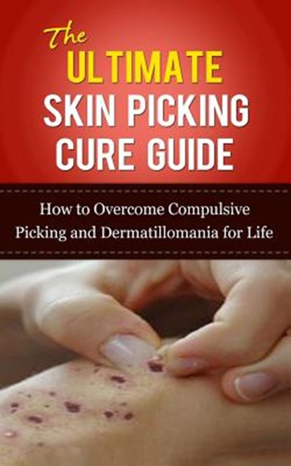 The Ultimate Skin Picking Cure Guide: How to Overcome Compulsive Picking and Dermatillomania for Life, Caesar Lincoln - Paperback - 9781507845332
