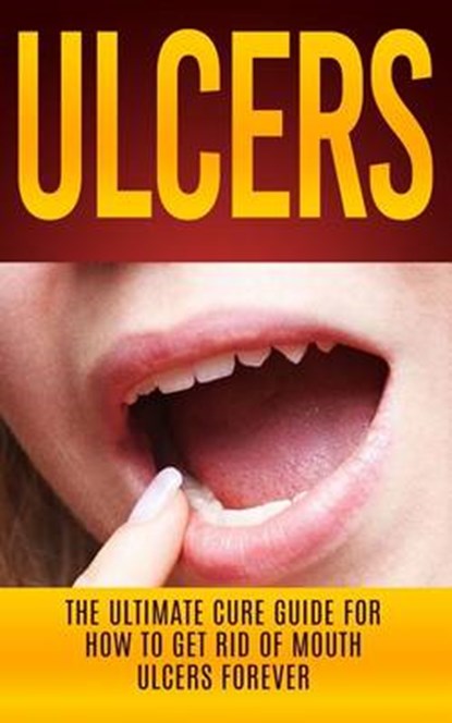 Ulcers: The Ultimate Cure Guide for How to Get Rid of Mouth Ulcers Instantly, Wade Migan - Paperback - 9781507877081