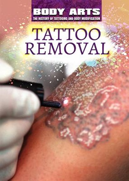 Tattoo Removal, Nicholas Faulkner - Gebonden - 9781508180791