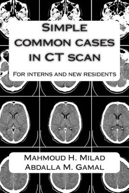 Simple common cases in CT scan: For interns and new residents, Abdalla M. Gamal - Paperback - 9781514709962