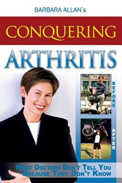 Conquering Arthritis: What Doctors Don't Tell You Because They Don't Know, Barbara D. Allan - Paperback - 9781515079545