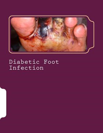 Diabetic Foot Infection, Syed Shahmeer Raza - Paperback - 9781519448781