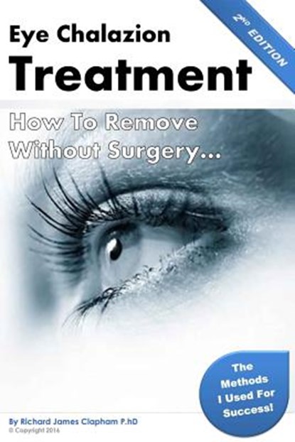 Eye Chalazion: How To Remove Without Surgery: My personal experience and the methods I used for success, Richard James Clapham Phd - Paperback - 9781523853656
