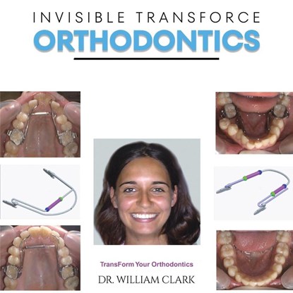 Invisible TransForce Orthodontics, Dr. William Clark - Paperback - 9781528946131