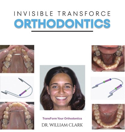 Invisible TransForce Orthodontics, Dr. William Clark - Gebonden - 9781528950046