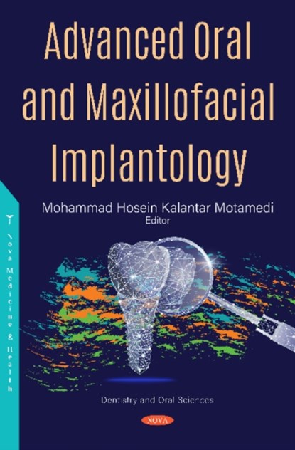 Advanced Oral and Maxillofacial Implantology, Mohammad Hosein Kalantar Motamedi - Gebonden - 9781536169317