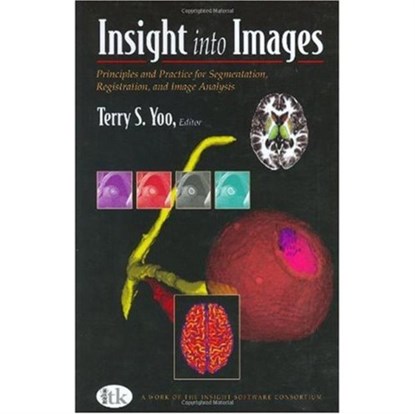 Insight into Images, Terry S. Yoo - Gebonden - 9781568812175