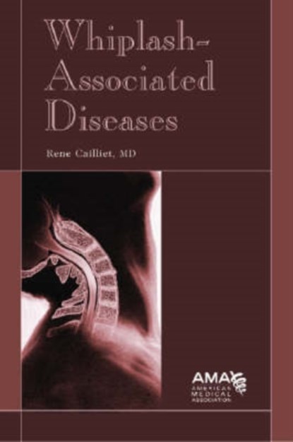 Whiplash-Associated Diseases, Rene Cailliet - Paperback - 9781579477745