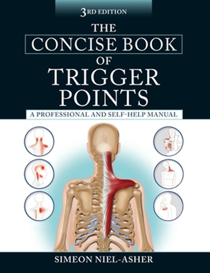 CONCISE BK OF TRIGGER POINTS 3, Simeon Niel-Asher - Paperback - 9781583948491