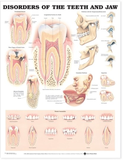 Disorders of the Teeth and Jaw Anatomical Chart, niet bekend - Gebonden - 9781587792496
