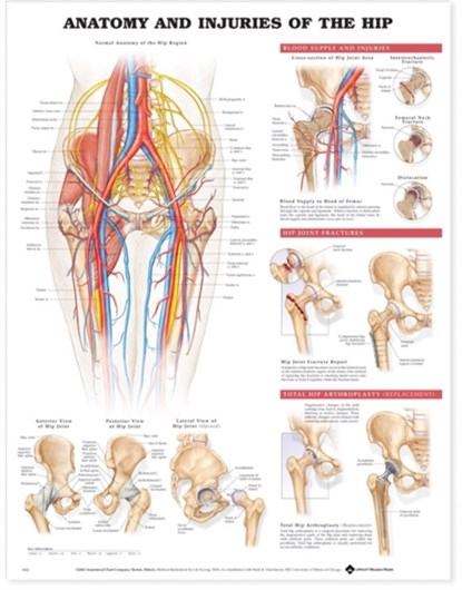 Anatomy and Injuries of the Hip Anatomical Chart, niet bekend - Gebonden - 9781587793820