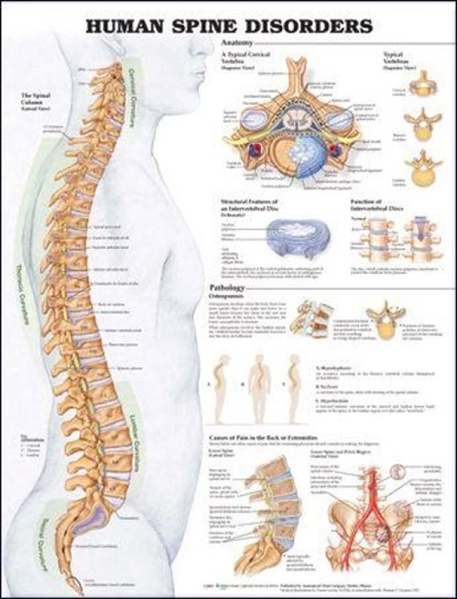 Human Spine Disorders Anatomical Chart, Anatomical Chart Company - Gebonden - 9781587794438
