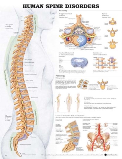 Human Spine Disorders Anatomical Chart, Anatomical Chart Company - Gebonden - 9781587794438