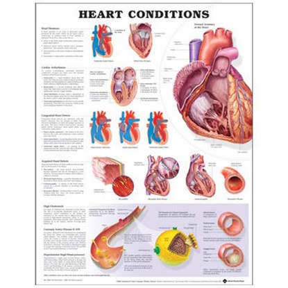 Heart Conditions, niet bekend - Gebonden - 9781587798825