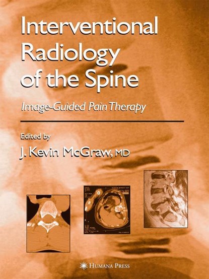 Interventional Radiology of the Spine, J. Kevin McGraw - Gebonden - 9781588291981