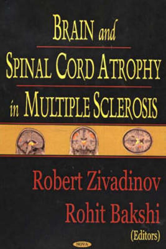 Brain & Spinal Cord Atrophy in Multiple Sclerosis