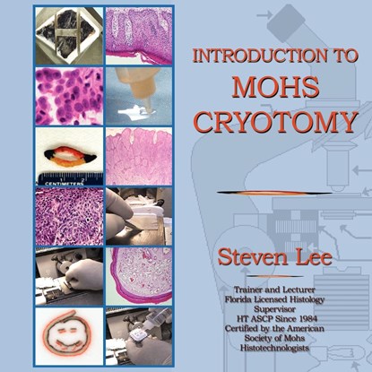 Introduction to MOHS Cryotomy, Steven Lee - Paperback - 9781595408648
