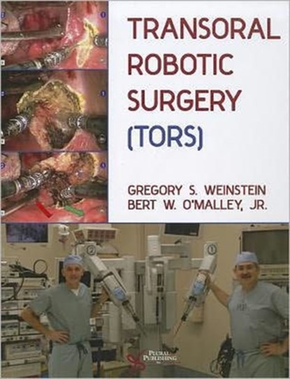 Transoral Robotic Surgery (TORS), Gregory S. Weinstein ; Bert W. O'Malley - Gebonden - 9781597560740