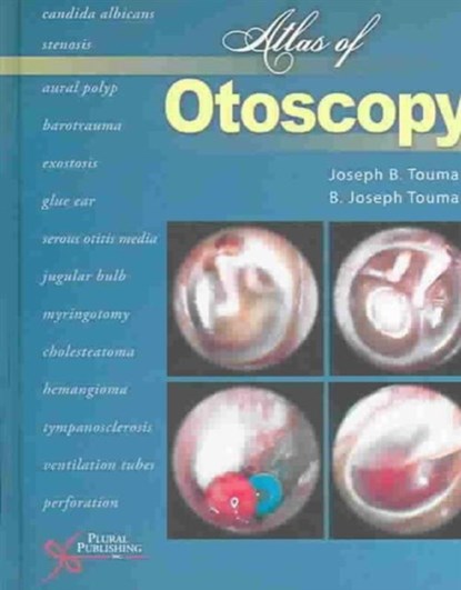 Atlas of Otoscopy, Joseph B. Touma ; B. Joseph Touma - Gebonden - 9781597560931