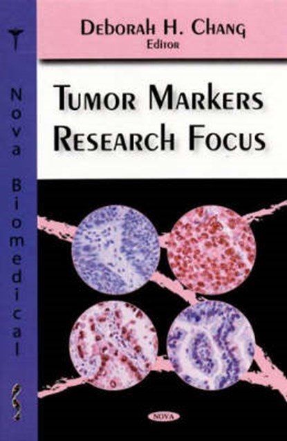 Tumor Markers Research Focus, CHANG,  Deborah H - Gebonden - 9781600215445